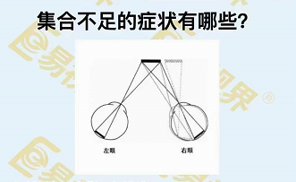 集合不足的癥狀有哪些？
